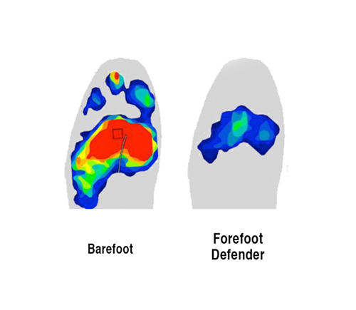 Forefoot Defender™ Forefoot Defender™