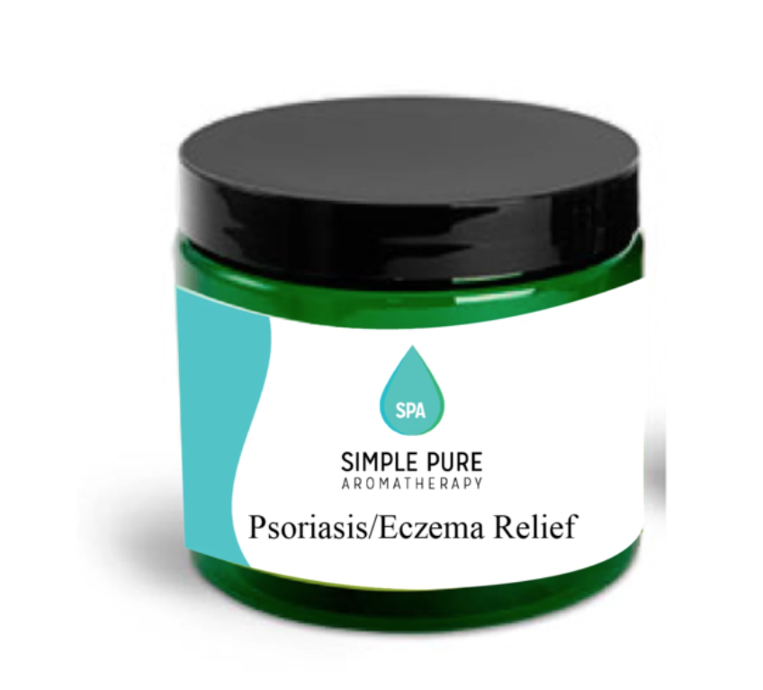 CBD Psoriasis/ Eczema Cream