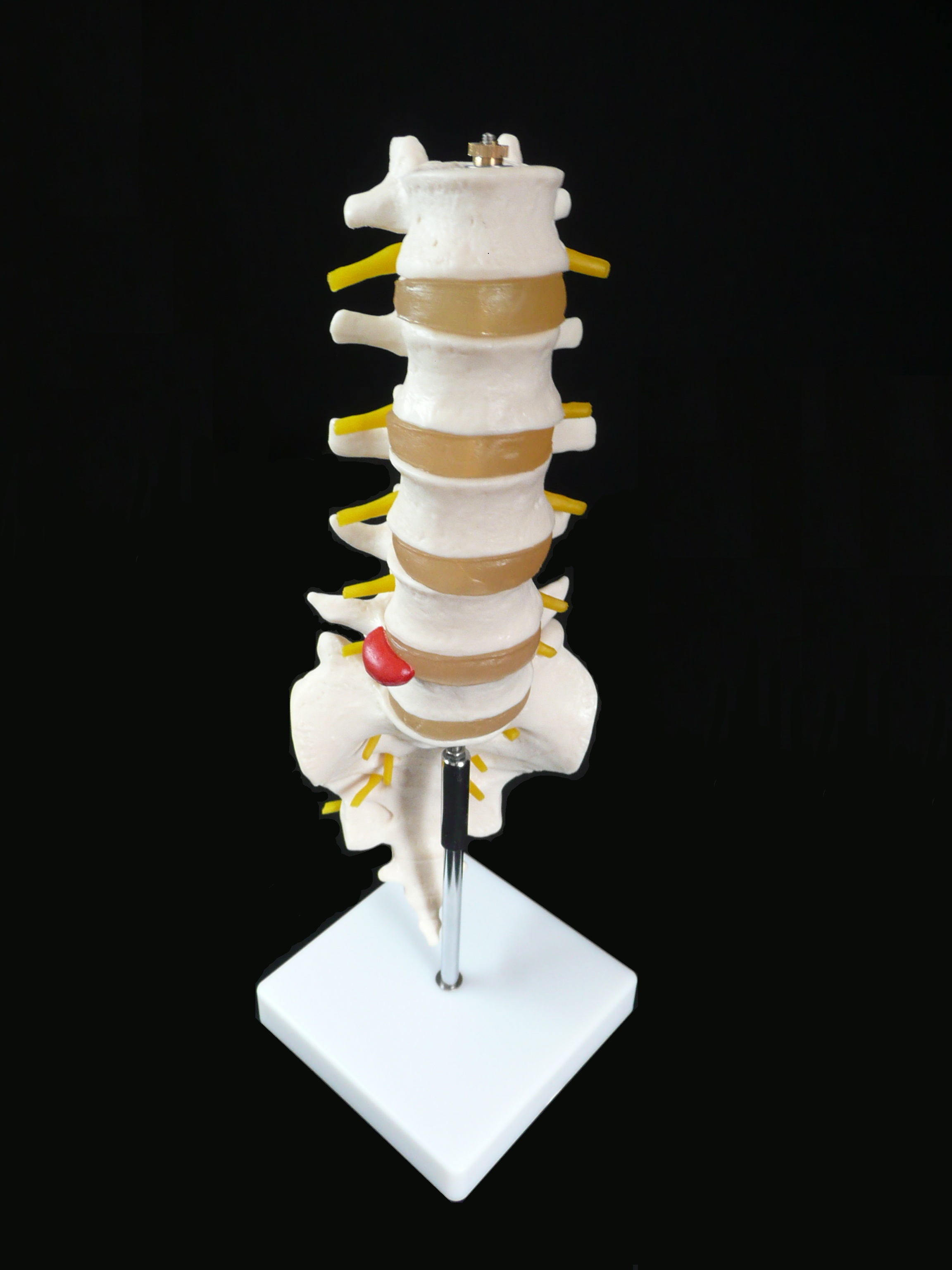 Anatomical Human Life-Size Lumbar Vertebrae with Sacrum & Coccyx and ...